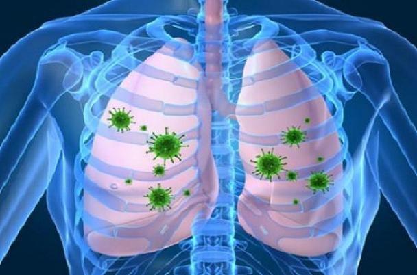 مبتلایان HIV با ریسک بالای بیماری انسداد مزمن ریوی مواجه مبتلایان HIV با ریسک بالای بیماری انسداد مزمن ریوی روبرو اند
