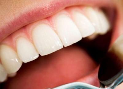 کدام کار های روزمره دندان ها را خراب می نمایند؟