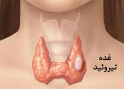 علائم سرطان تیروئید