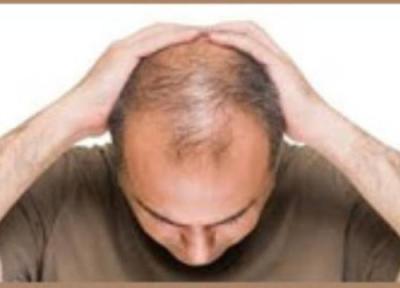 مسائل تیروئید و ریزش مو